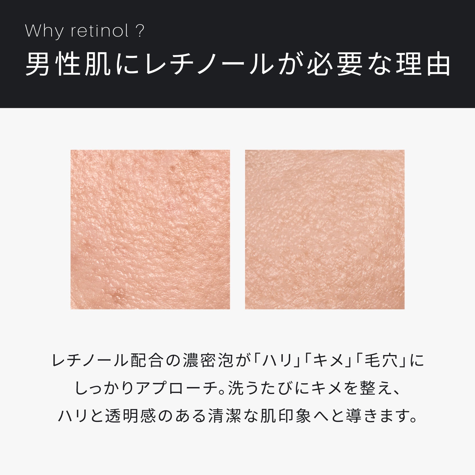 豪華6点セット✨メンズ スキンケア まとめ売り レチノール美容液 導入ミスト 他 ATIDIMU 洗顔フォーム｜レチノール誘導体配合メンズ洗顔