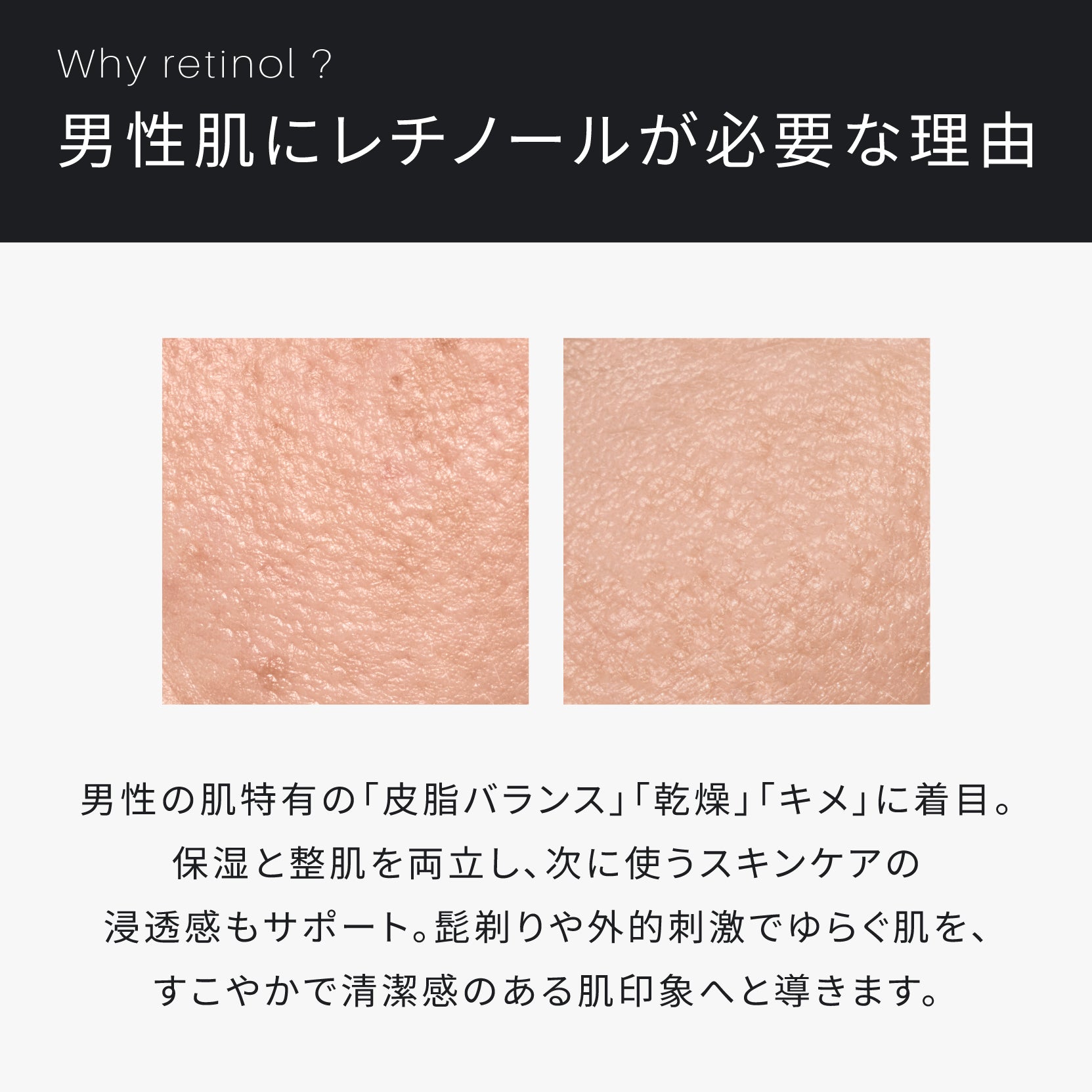 ATIDIMU メンズ化粧水 レチノール誘導体を配合する理由と男性肌の乾燥・皮脂バランスを説明したイメージ