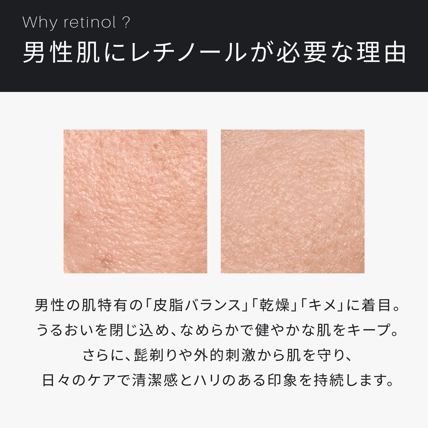 ATIDIMU メンズ乳液 レチノール誘導体を配合する理由と男性肌の乾燥・皮脂バランスを説明したイメージ