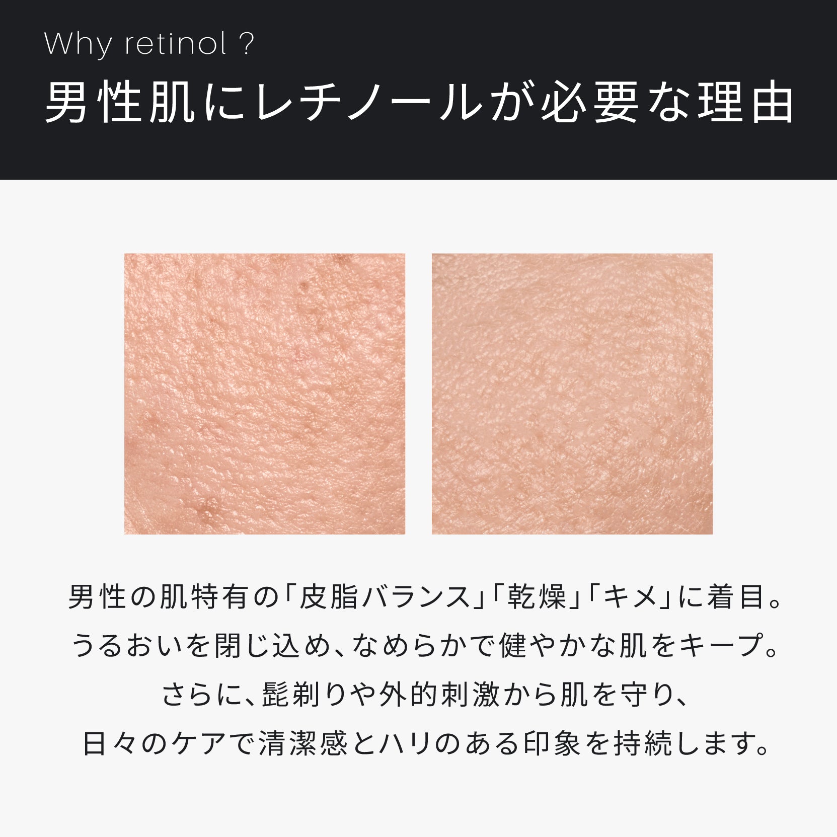 ATIDIMU メンズ乳液 レチノール誘導体を配合する理由と男性肌の乾燥・皮脂バランスを説明したイメージ