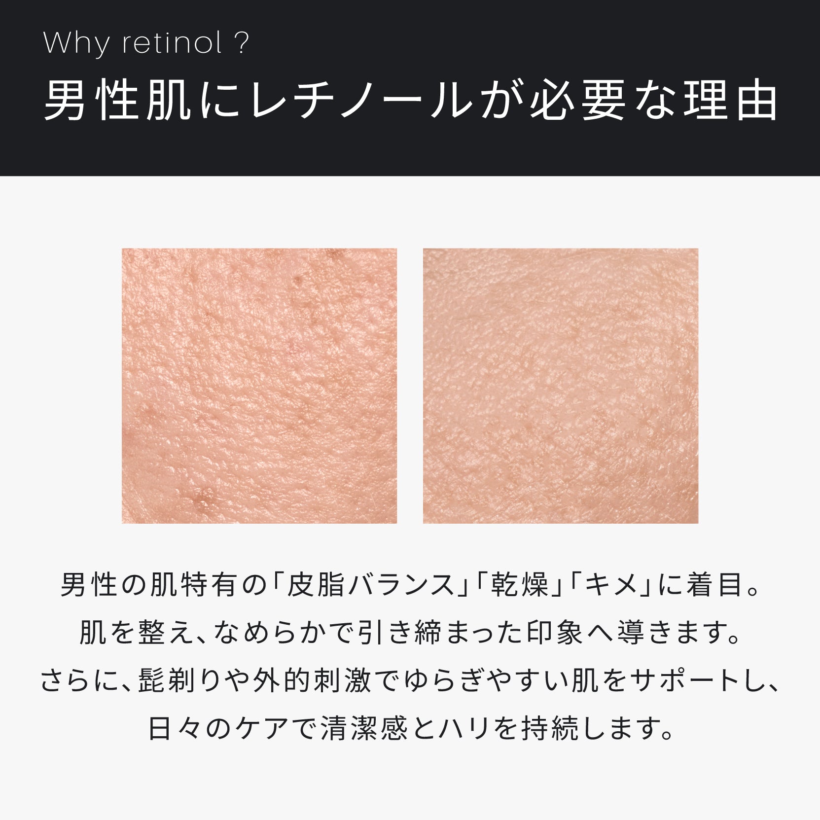 ATIDIMU（アティディム） 美容液