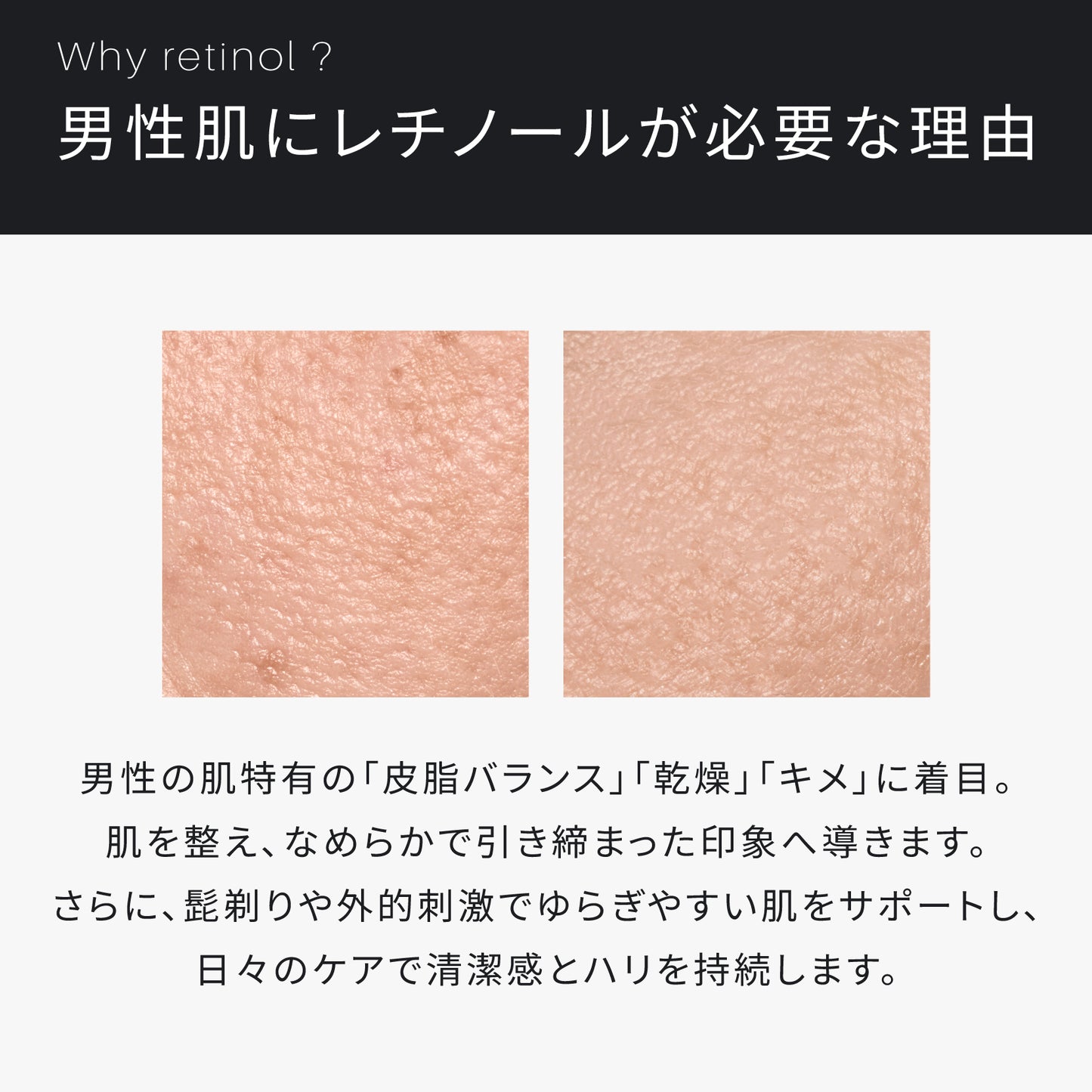 ATIDIMU メンズ美容液 レチノール誘導体を配合する理由と男性肌の乾燥・皮脂バランスを説明したイメージ